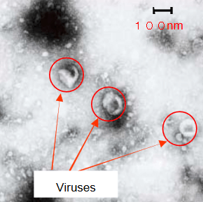 koronawirusy pod mikroskopem